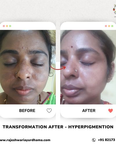 Ayurvedic Skin & Hair Treatments