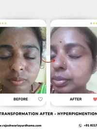 Ayurvedic Skin & Hair Treatments