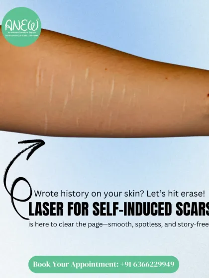 Your past doesn't have to leave a permanent mark. Our advanced laser for self-induced scars works to clear the page by promoting collagen, smoothing texture, and restoring even-toned, story-free skin.