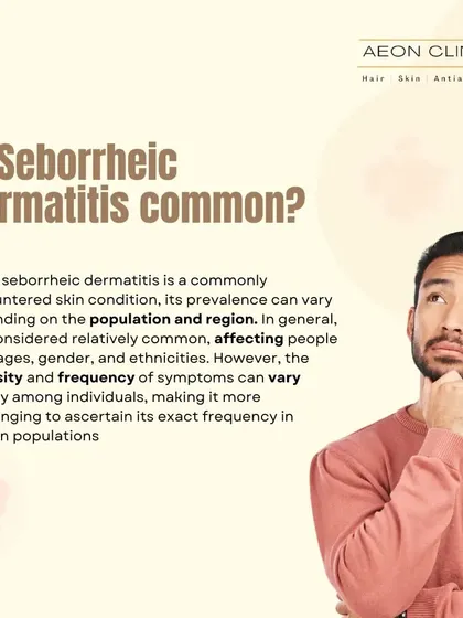 Is Seborrheic Dermatitis common? Yes, this skin condition affects many people and can cause issues like a flaky scalp. This post explains its prevalence and why getting a proper diagnosis is important, as symptoms can vary greatly.
