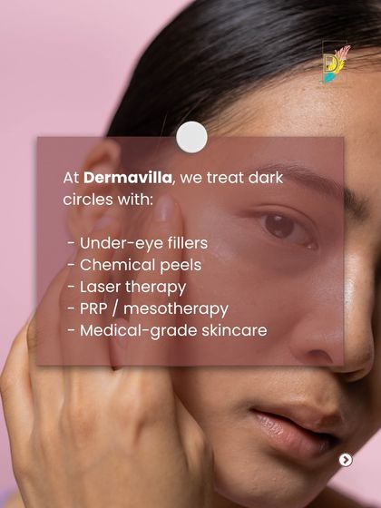 At my clinic, I offer a range of effective treatments for dark circles. Depending on your specific need, we can use under-eye fillers, chemical peels, laser therapy, or medical-grade skincare to achieve visible results.