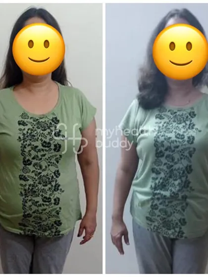 A front view of the client who lost 3 kgs at 48. Her journey is about feeling energetic and learning how to sustain a healthy lifestyle long-term.