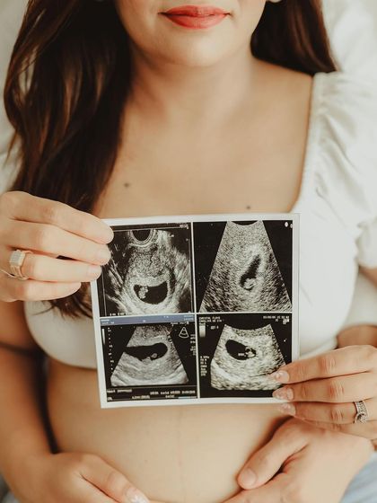 The first glimpse of your baby. Holding the sonogram picture over the bump is a powerful and emotional photo that connects the before and after.