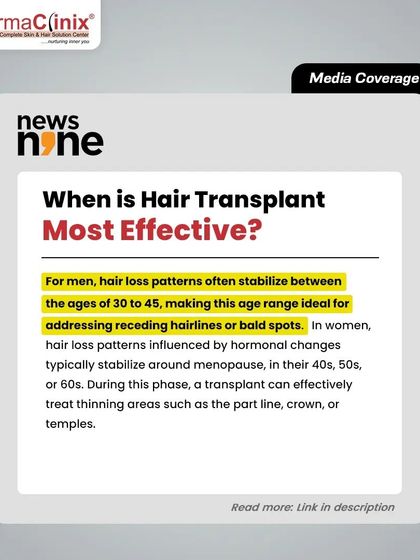 This article excerpt explains when a hair transplant is most effective for men and women based on when their hair loss patterns typically stabilize.