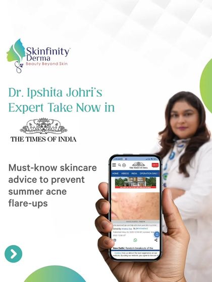 We are proud to have our founder, Dr. Ipshita Johri, featured in The Times of India. In the article, she shares her expert advice on preventing summer acne flare-ups, a must-read for clear skin.