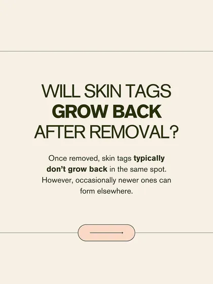 Will skin tags grow back after removal? Typically, they do not grow back in the same spot. However, new ones can occasionally form elsewhere, especially if you are prone to them.
