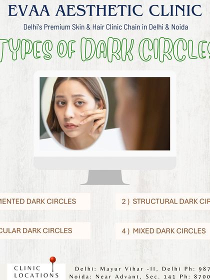 We diagnose and treat different types of dark circles, including pigmented, structural, vascular, and mixed, to provide the most effective solution.