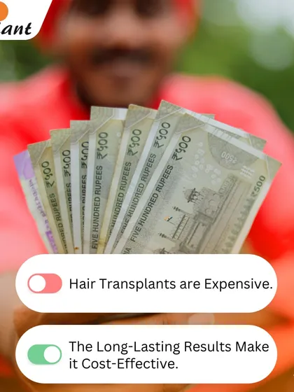 Myth: Hair transplants are expensive. Truth: While there is an initial investment, the results are permanent. When you compare it to the ongoing cost of temporary solutions like hair systems or medications over a lifetime, a transplant is often the most cost-effective solution.