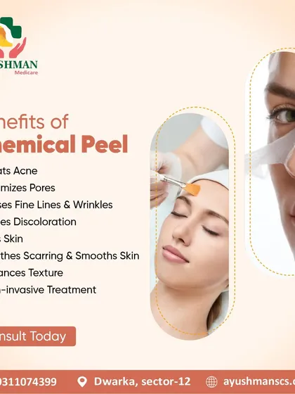 This graphic highlights the many benefits of a chemical peel, from treating acne and minimizing pores to erasing fine lines and smoothing skin texture. It's a non-invasive way to achieve a balanced complexion.