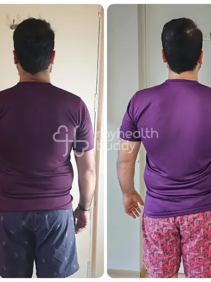Another back view of Anshul's 10kg loss.