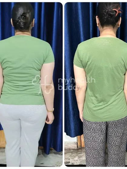 Back view of the 10kg transformation.