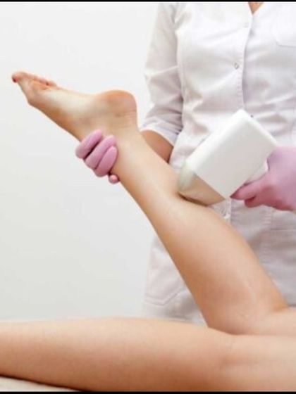 A laser hair reduction session for the legs in progress. This treatment saves a significant amount of time in the long run and is a cost effective solution compared to a lifetime of waxing or buying razors.