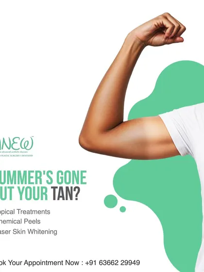 Summer's gone, but is your tan? We offer effective tan removal treatments including topical solutions, chemical peels, and laser skin whitening to help you reclaim your radiant, even-toned glow.