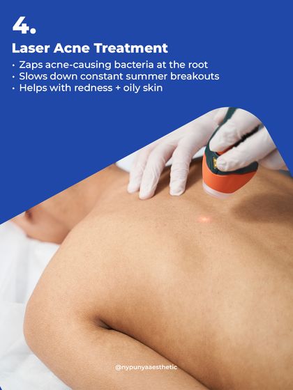 Laser acne treatment is a powerful tool against persistent back acne. The laser targets and zaps acne-causing bacteria at the root, which helps to slow down constant breakouts and reduce associated redness and oiliness.