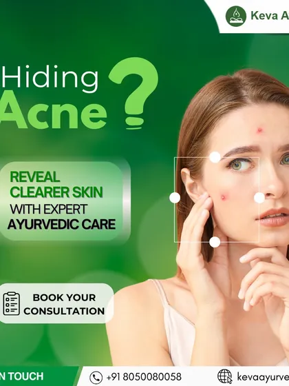 If you are struggling with persistent acne, you don't have to hide it. Our expert Ayurvedic care focuses on revealing clearer, healthier skin by treating the internal imbalances that cause breakouts, offering a natural and long-lasting solution.