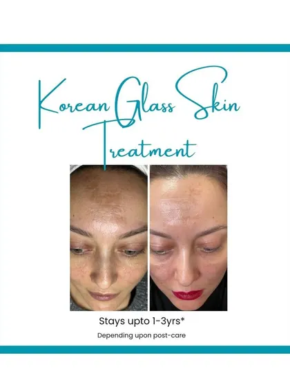 This graphic shows a clear before-and-after, emphasizing that the radiant results of the Korean Glass Skin treatment can last for up to 1-3 years.