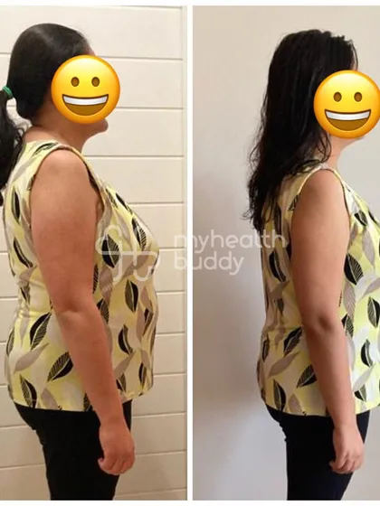 This client's side profile after losing 7 kgs. Her story shows that fitness is achievable even with hormonal imbalances and a busy schedule.