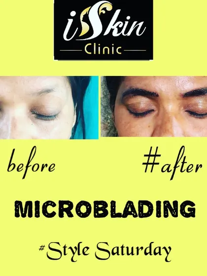 Before and after our microblading eyebrow enhancement service. We created fuller, more defined, and natural-looking brows that frame the eyes, correcting the previous sparse appearance.