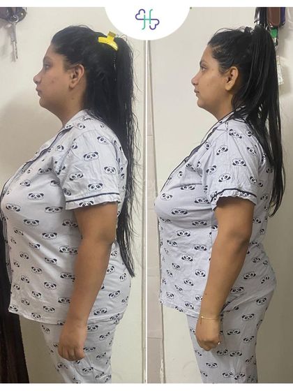 Vidhi lost 7 kgs in 12 weeks and saw improvements in her overall health, including regulating her periods naturally.