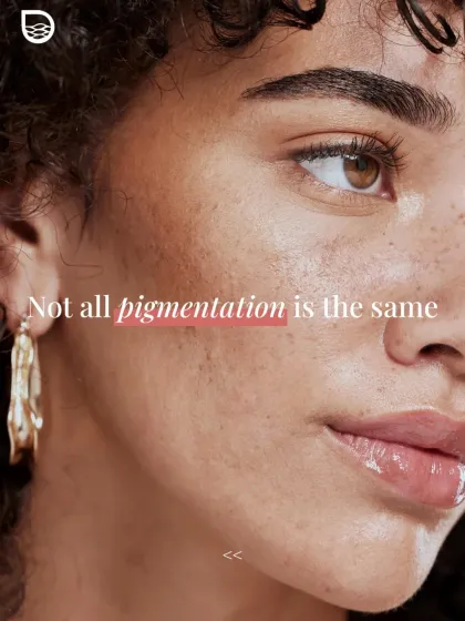 Understanding the root cause of your pigmentation is the first step. Whether it's hormonal melasma, sun spots, or post-acne marks, I create a tailored treatment plan because a generic approach doesn't deliver real results.