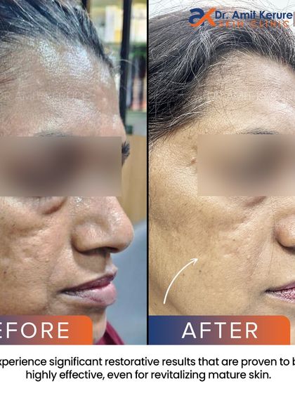 This angle highlights the restorative results on mature skin, proving that advanced treatments can be highly effective at any age.