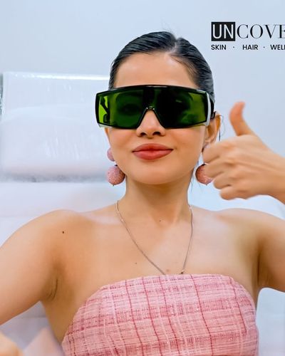 Laser Hair Removal