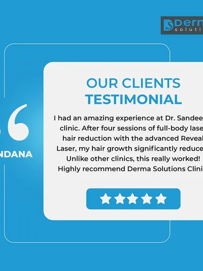 We are proud to share feedback from our clients. This testimonial highlights the significant reduction in hair growth after just four sessions of full body laser hair reduction, showcasing the effectiveness of our advanced Reveal Laser technology.
