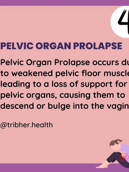 Pelvic organ prolapse occurs when weakened pelvic floor muscles can no longer support the pelvic organs. Our exercises are designed to strengthen this crucial support system.