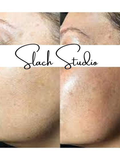 A close-up on skin texture, showing how the treatment refines pores and smooths fine lines for a glass-like finish.