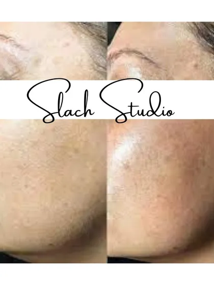A close-up on skin texture, showing how the treatment refines pores and smooths fine lines for a glass-like finish.