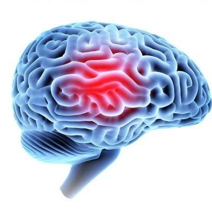 A Traumatic Brain Injury (TBI) can have a wide range of physical and cognitive effects. My neurological rehabilitation programs are designed to help patients regain function and independence.