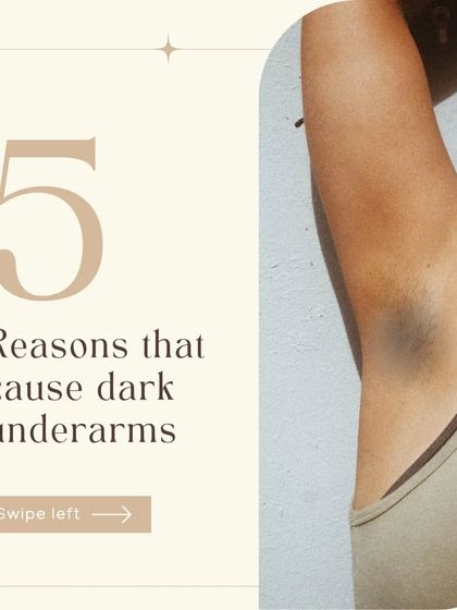 Here are five common reasons that cause dark underarms. Understanding the 'why' is crucial before starting any treatment, as it helps us tailor the most effective plan for you.