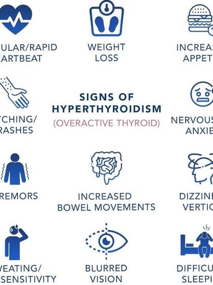An overactive thyroid, known as hyperthyroidism, presents with a different set of signs. Look for symptoms like an irregular heartbeat, unexplained weight loss, anxiety, and difficulty sleeping, as these may indicate a thyroid imbalance.