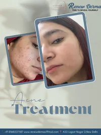 Advanced Skin Treatments