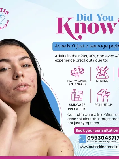 Did you know acne isn't just a teenage problem? We treat adult acne caused by hormones, stress, and other factors by creating customized solutions that target the root cause, not just the surface symptoms.