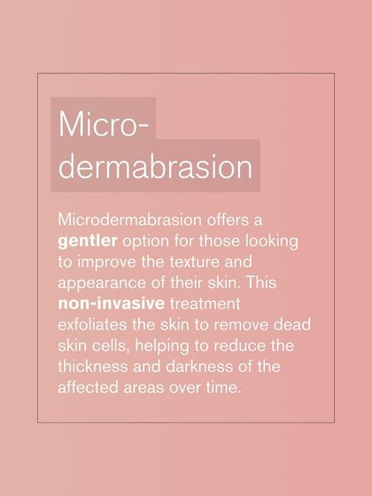 Microdermabrasion offers a gentler, non-invasive option for Acanthosis Nigricans. It exfoliates the skin to reduce the thickness and darkness of the affected areas over time.