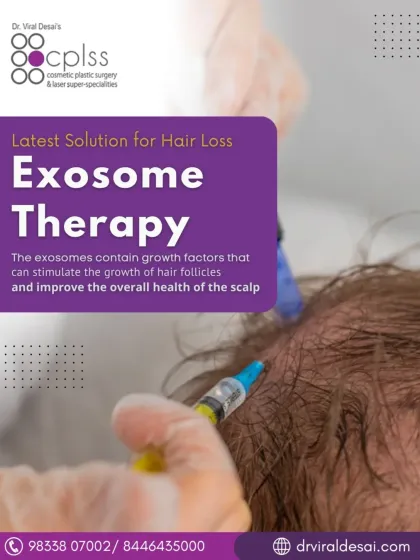 Here you can see the application of Exosome Therapy, one of the latest non-surgical solutions I offer for hair loss. This treatment uses growth factors to stimulate hair follicles and improve the overall health of your scalp, promoting natural regrowth.