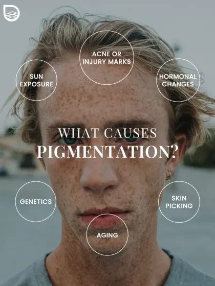 What causes pigmentation? This graphic illustrates the multiple factors, including sun exposure, genetics, hormonal changes, and even skin picking, that can lead to uneven skin tone.