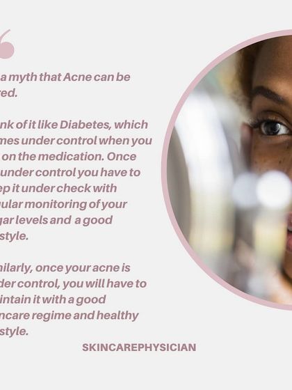It's a myth that acne can be "cured." Like other chronic conditions, it can be managed and controlled with a consistent skincare regimen and healthy lifestyle, even after active breakouts are gone.