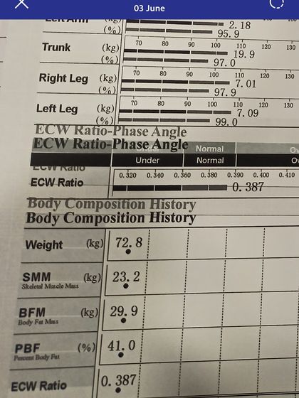 This InBody report from the first four weeks of a patient's journey shows a 2 kg fat loss combined with a 1.5 kg muscle gain. This is body recomposition in action, where we focus on improving your metabolic health and strength, not just the number on the scale.