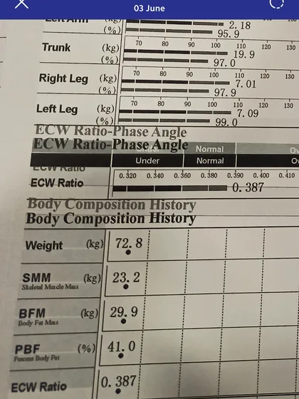 This InBody report from the first four weeks of a patient's journey shows a 2 kg fat loss combined with a 1.5 kg muscle gain. This is body recomposition in action, where we focus on improving your metabolic health and strength, not just the number on the scale.