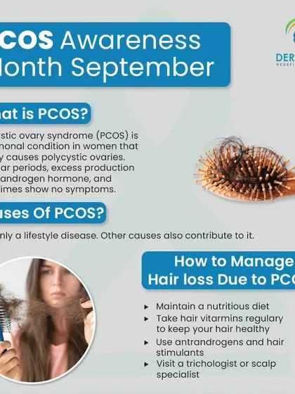 For PCOS Awareness Month, this graphic explains how the condition can cause hair loss and provides tips on how to manage it, such as maintaining a healthy diet and consulting a specialist.