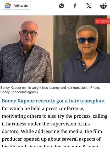 A news clipping showing Boney Kapoor discussing his hair transplant. He motivated others by calling the process harmless under the supervision of his doctors, which I am honored to be.