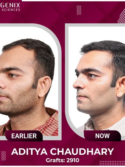 Sub-inspector Aditya Chaudhary explains how his undetectable transplant restored the confidence he needs in his line of duty.