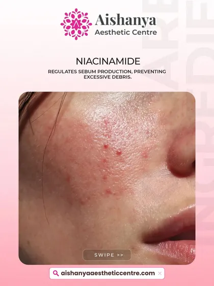 Niacinamide is a powerhouse ingredient. It helps regulate your skin's oil production, which prevents the buildup of debris in your pores that can make them look larger.