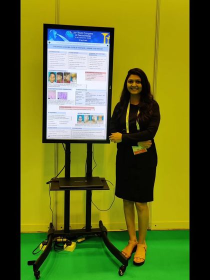 Presenting my research at the World Congress of Dermatology 2023 was an incredible experience. Sharing knowledge and engaging with peers is vital to advancing the field and improving patient care.