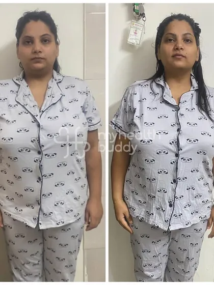 A front view of Vidhi's 7 kg weight loss. She not only lost weight but also improved her PCOD symptoms and became more active.