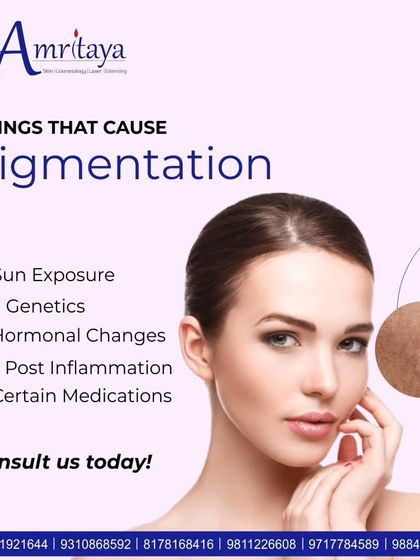 This graphic explains the common causes of pigmentation, including sun exposure, genetics, and hormonal changes. We offer expert consultations to find the right solution for you.