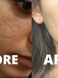 Laser Skin & Hair Treatments