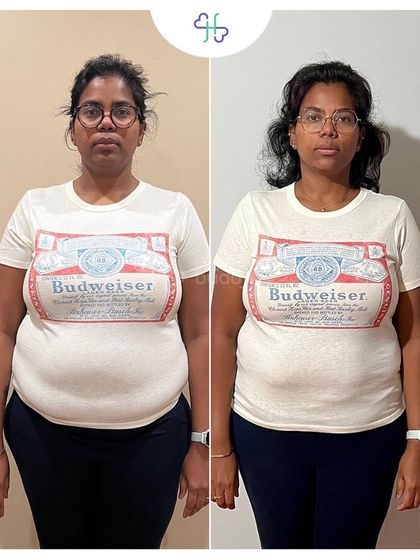 This client lost 5 kgs in 6 months by following a simple plan of home-cooked meals and regular workouts. She learned to make mindful choices and transitioned to a healthier lifestyle.
